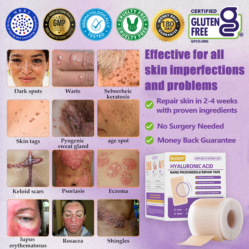 Totai Увереността в кожата започва оттук ✅ Bostore® Нано микроигли с хиалуронова киселина за възстановяване на кожата ✴️ За различни белези, стрии, петна, келоиди, кератози, акне, изгаряния, брадавици, кожни израстъци и разширени вени.