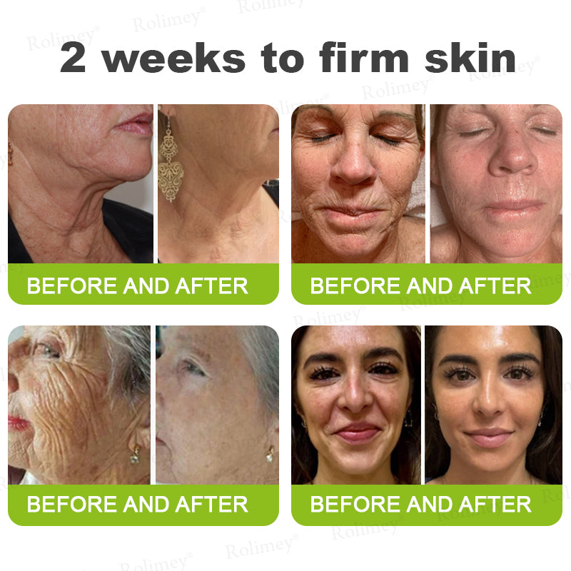 💛✅Произведено и изпратено от САЩ 💫Rolimey® Botox & Vita-A Retinol Shot крем за повдигане, стягане и изглаждане на бръчки – Последен ден на промоцията: 70% ОТСТЪПКА