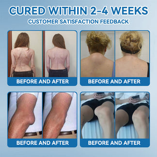 𝖯𝗂𝖼𝗱𝗼® BPC-157 Крем за възстановяване на ставите