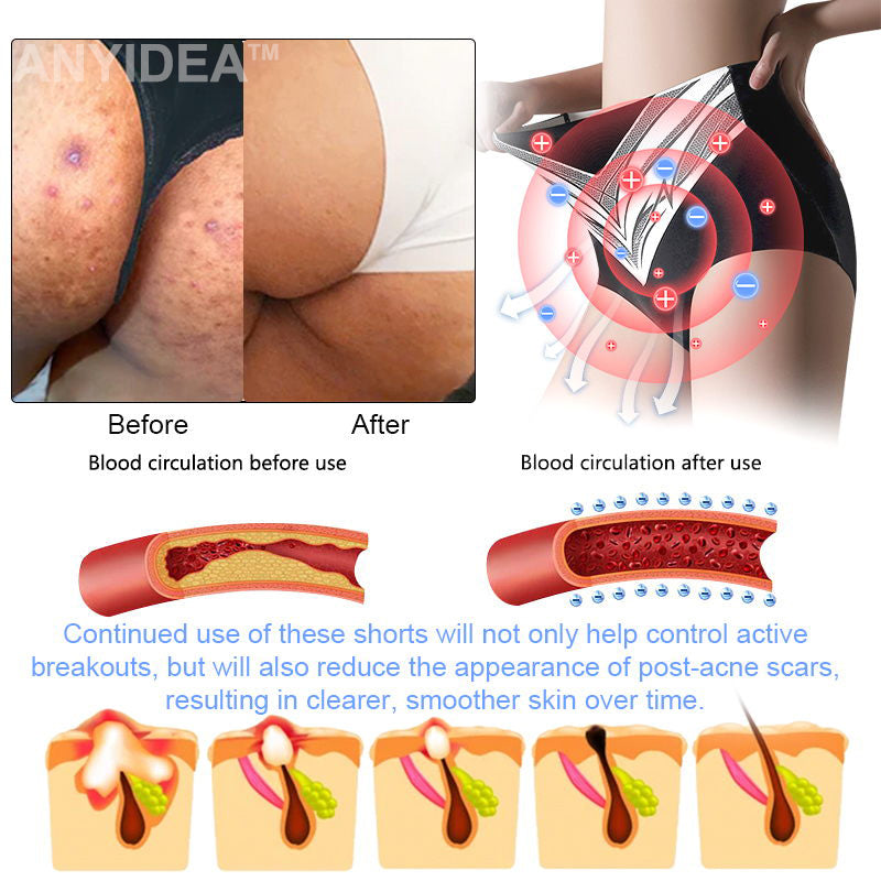 🎉 Ограничена оферта - огромна отстъпка! 💰Anyidea™ Саморегулиращи се шорти с турмалин и титанови влакна