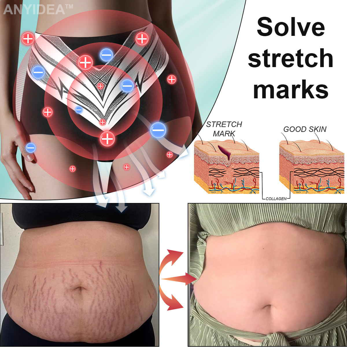 🎉 Ограничена оферта - огромна отстъпка! 💰Anyidea™ Саморегулиращи се шорти с турмалин и титанови влакна