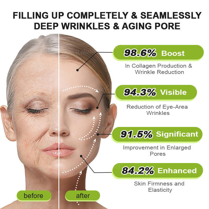 💛✅Произведено и изпратено от САЩ 💫Rolimey® Botox & Vita-A Retinol Shot крем за повдигане, стягане и изглаждане на бръчки – Последен ден на промоцията: 70% ОТСТЪПКА