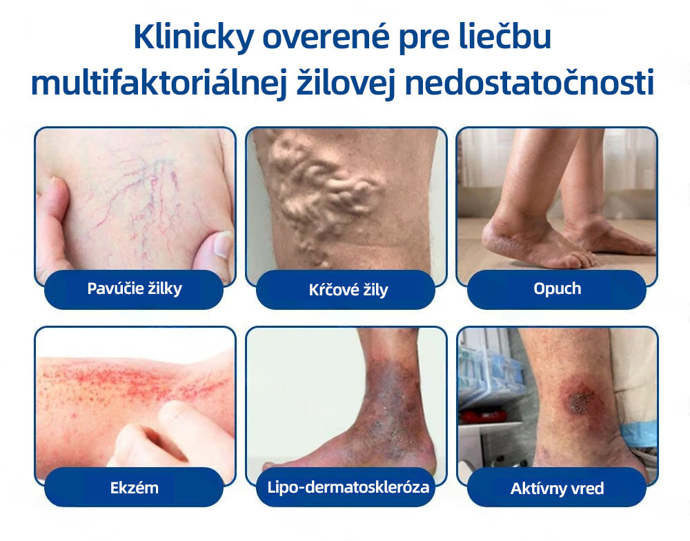 ✅👩‍⚕️👩‍⚕️ Healrize® VeinTarget микроиглен пластир ⚡ Незабавно облекчение, дълготрайни резултати