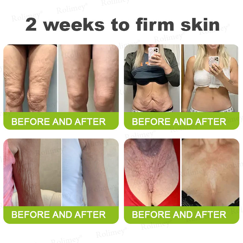 💛✅Произведено и изпратено от САЩ 💫Rolimey® Botox & Vita-A Retinol Shot крем за повдигане, стягане и изглаждане на бръчки – Последен ден на промоцията: 70% ОТСТЪПКА