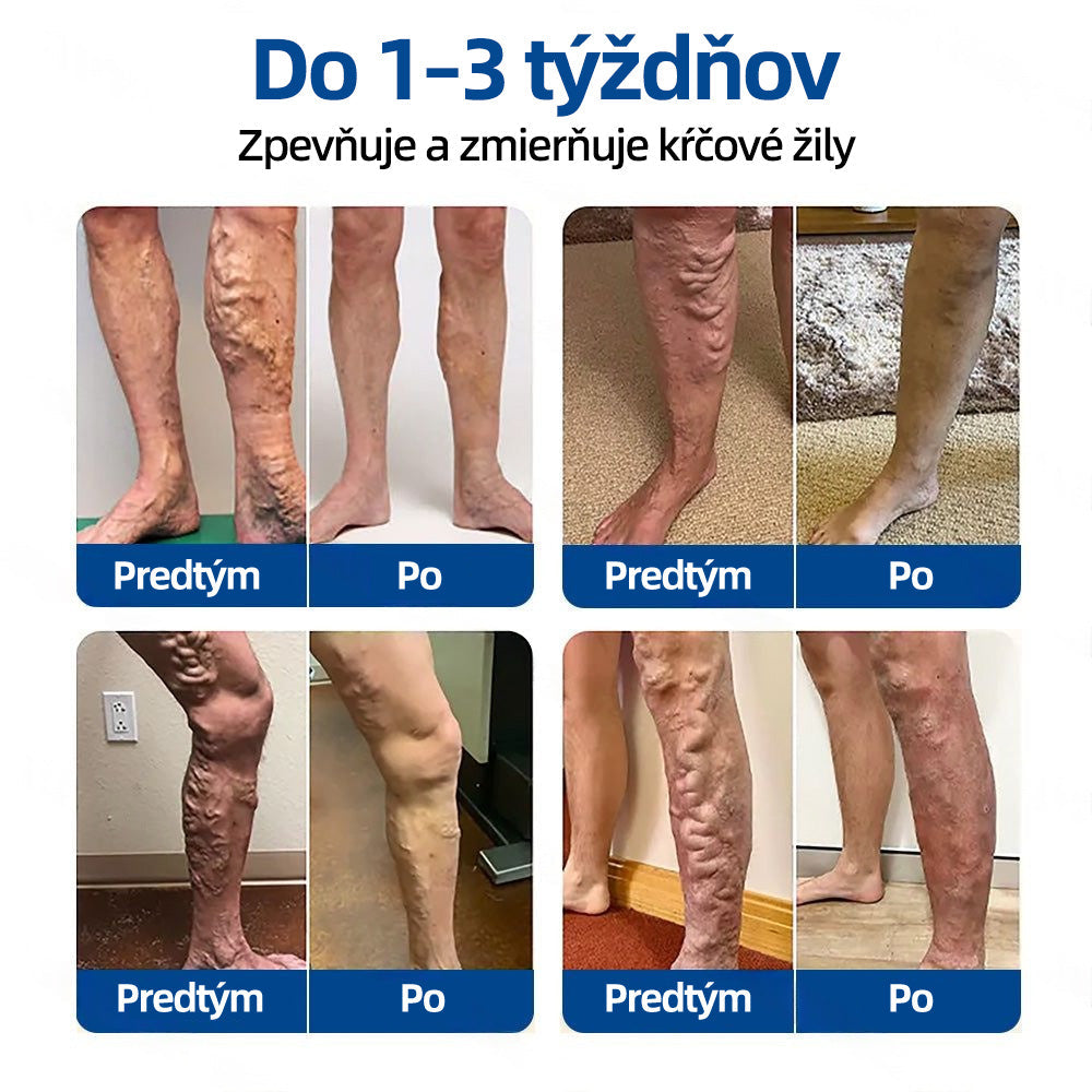 ✅👩‍⚕️👩‍⚕️ Healrize® VeinTarget микроиглен пластир ⚡ Незабавно облекчение, дълготрайни резултати