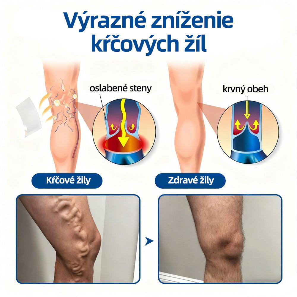 ✅👩‍⚕️👩‍⚕️ Healrize® VeinTarget микроиглен пластир ⚡ Незабавно облекчение, дълготрайни резултати