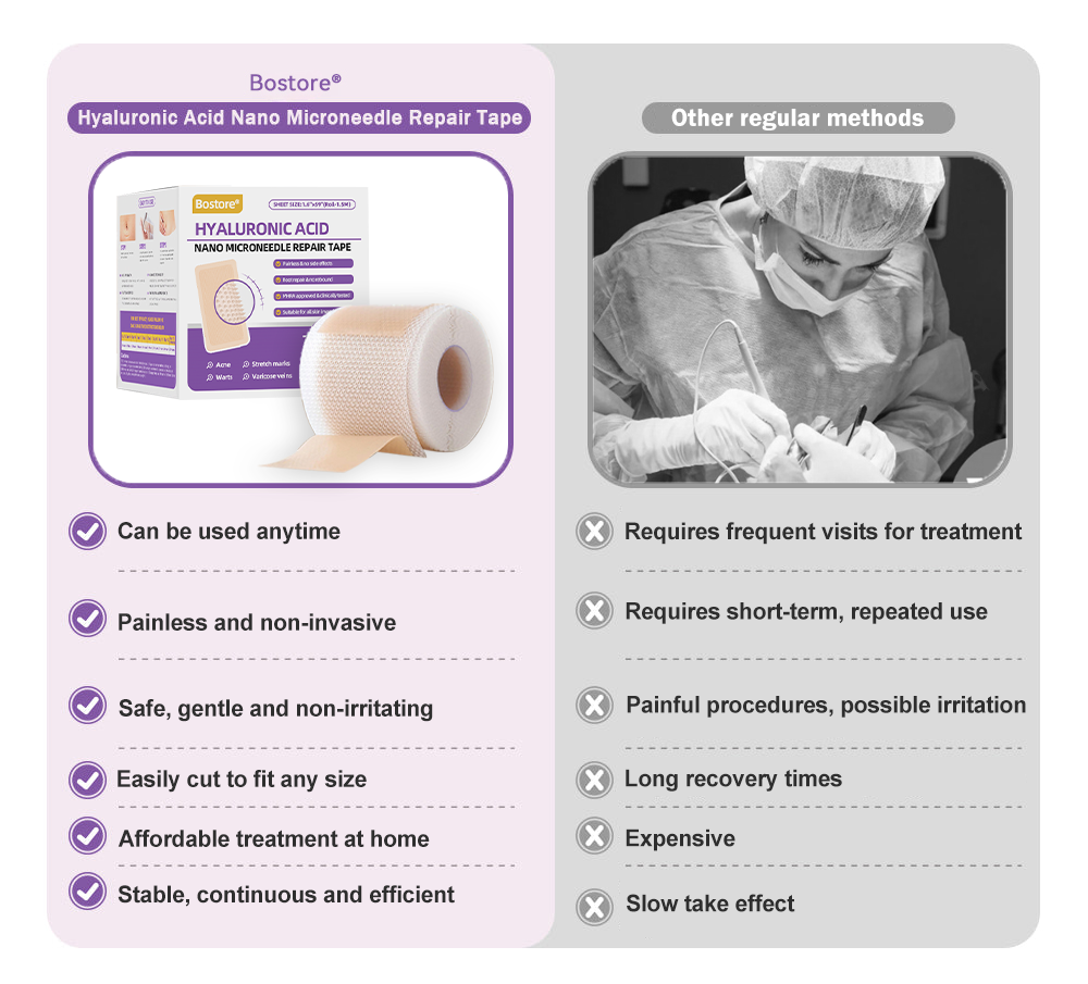 Totai Увереността в кожата започва оттук ✅ Bostore® Нано микроигли с хиалуронова киселина за възстановяване на кожата ✴️ За различни белези, стрии, петна, келоиди, кератози, акне, изгаряния, брадавици, кожни израстъци и разширени вени.