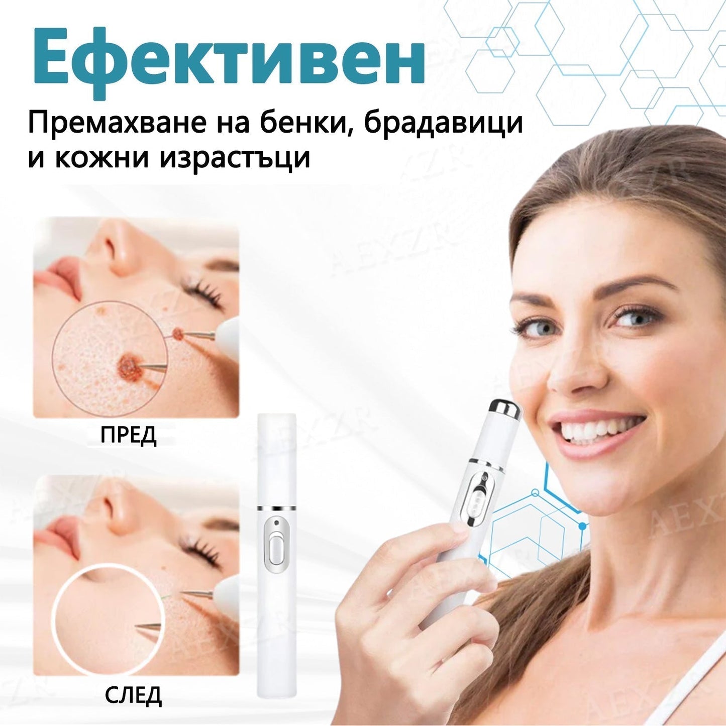 Bikenda® неинвазивна лазерна писалка за премахване на бенки и брадавици 🌟