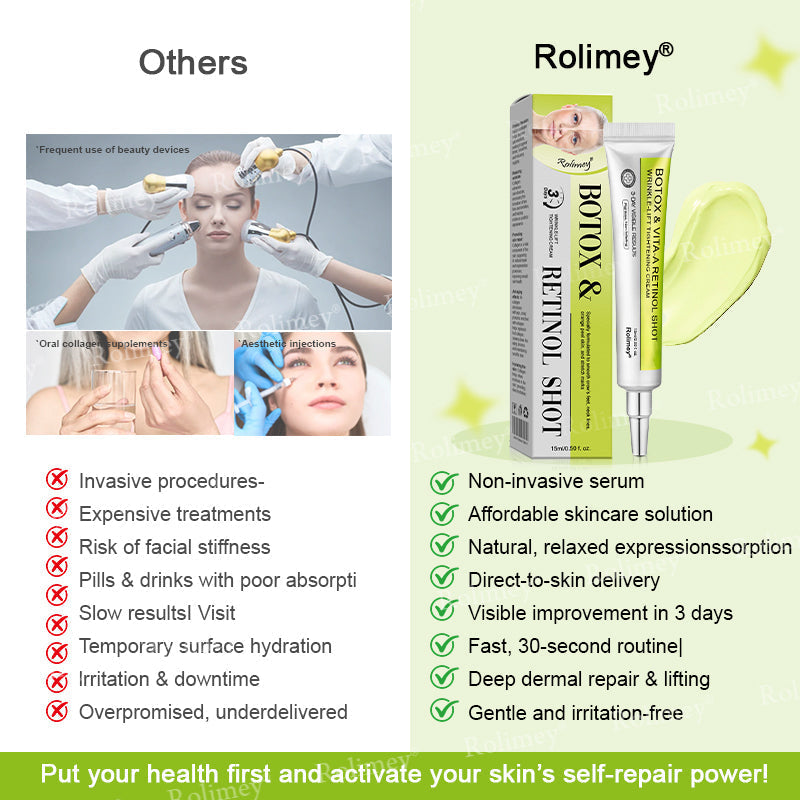 💛✅Произведено и изпратено от САЩ 💫Rolimey® Botox & Vita-A Retinol Shot крем за повдигане, стягане и изглаждане на бръчки – Последен ден на промоцията: 70% ОТСТЪПКА