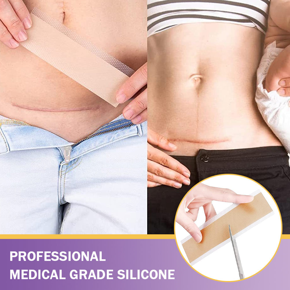 Totai Увереността в кожата започва оттук ✅ Bostore® Нано микроигли с хиалуронова киселина за възстановяване на кожата ✴️ За различни белези, стрии, петна, келоиди, кератози, акне, изгаряния, брадавици, кожни израстъци и разширени вени.